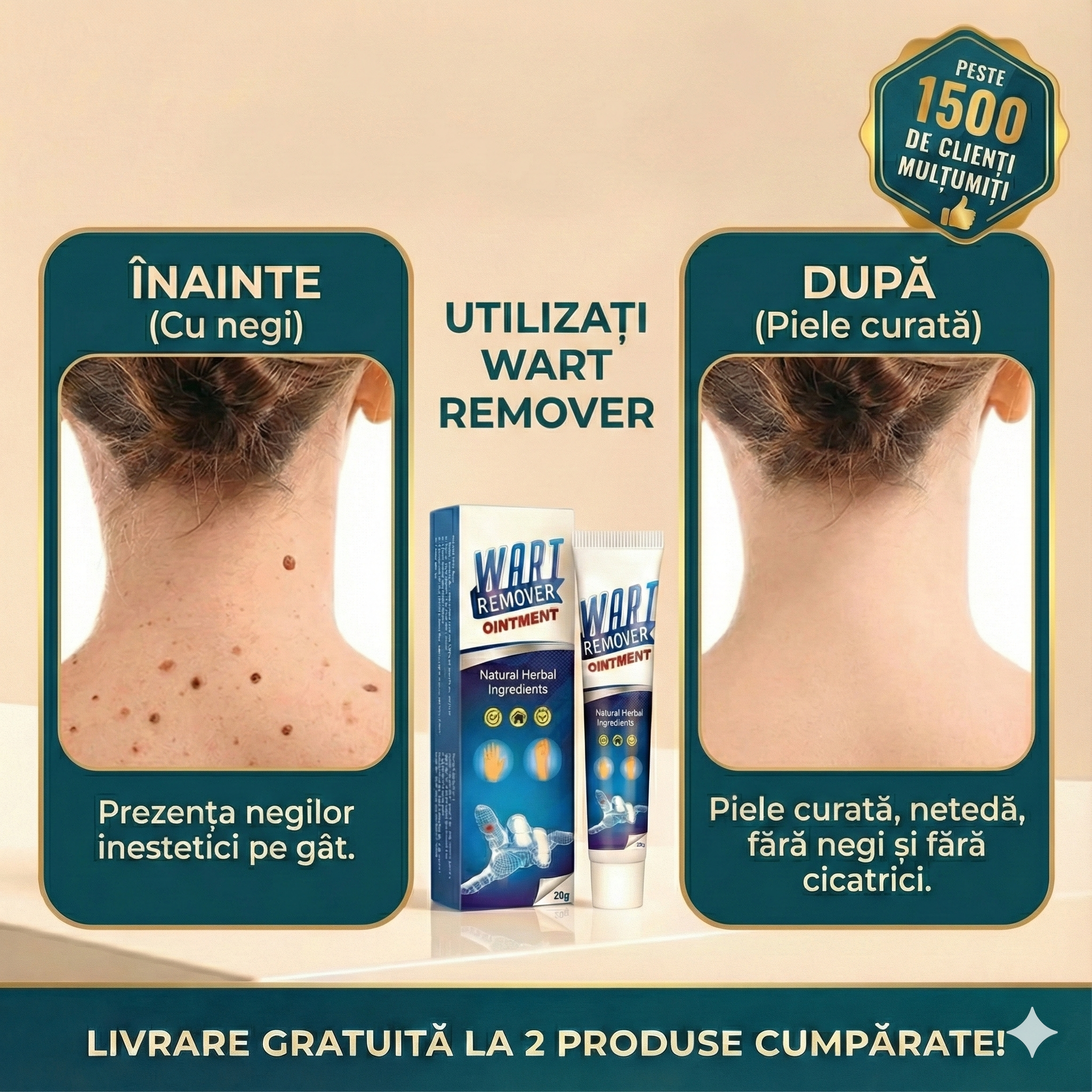 Wart Remover - Tratament Natural Anti-Negi