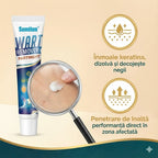 Wart Remover - Tratament Natural Anti-Negi